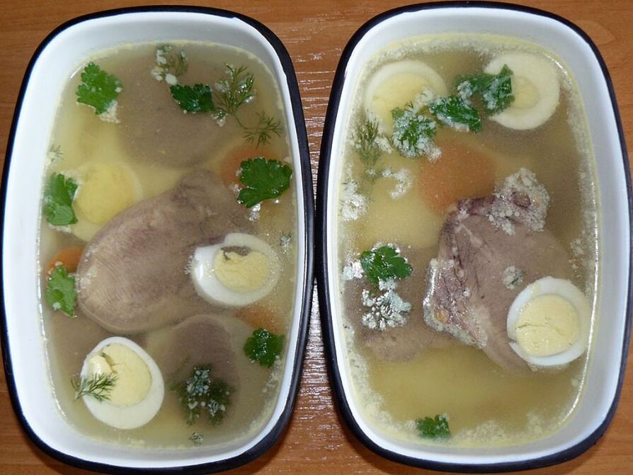 ASPIC alang sa arthrosis sa tuhod