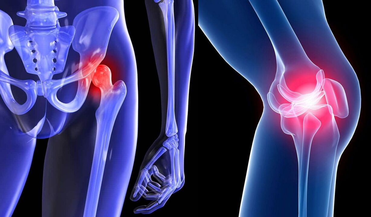 sintomas sa joint pain